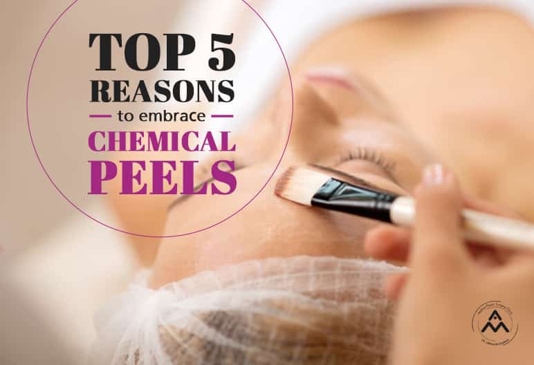 Top 5 Reasons To Embrace Chemical Peels