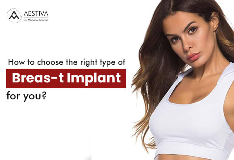 breas-t implant surgery in delhi