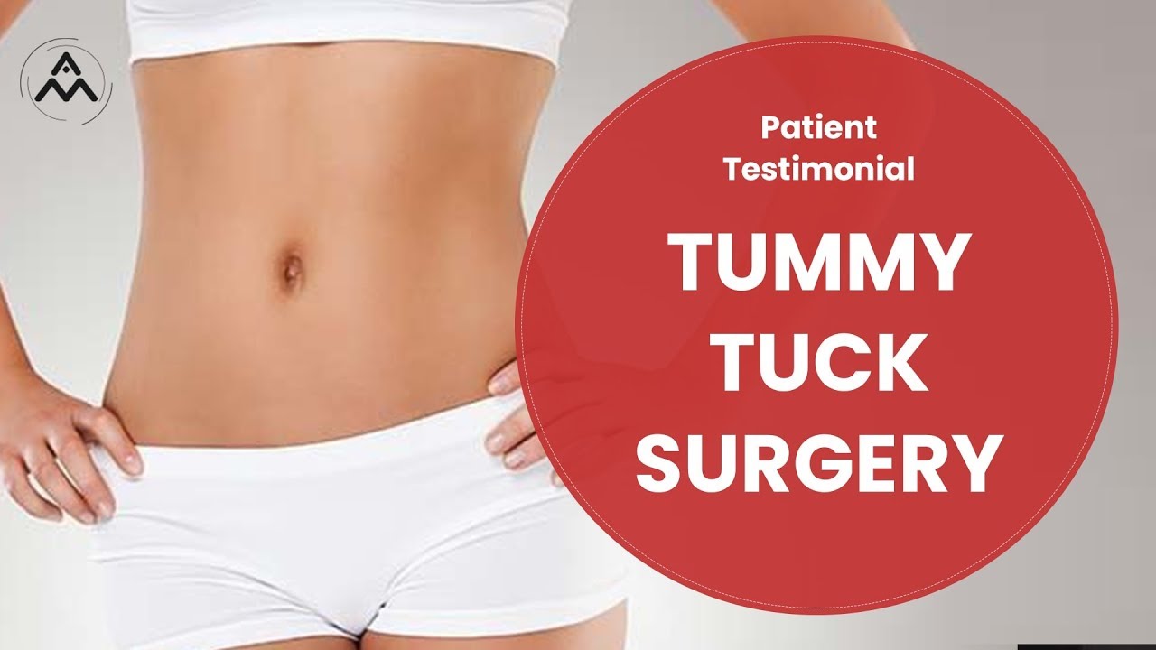 Patient Testimonial - Tummy Tuck Surgery | Aestiva Plastic Surgery Clinic in New Delhi