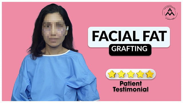 Patient Review after Facial Fat Grafting